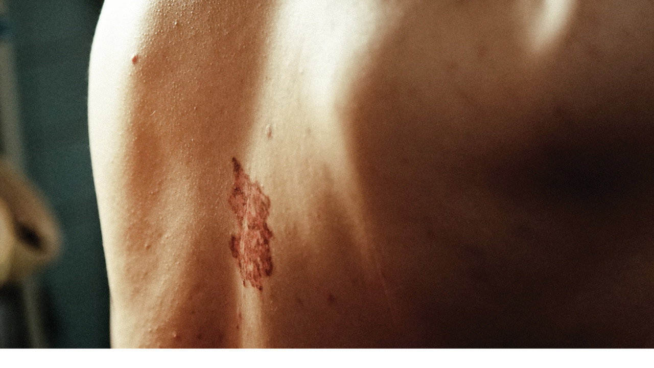 Original Wound backdrop