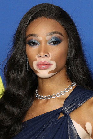 Winnie Harlow portrait