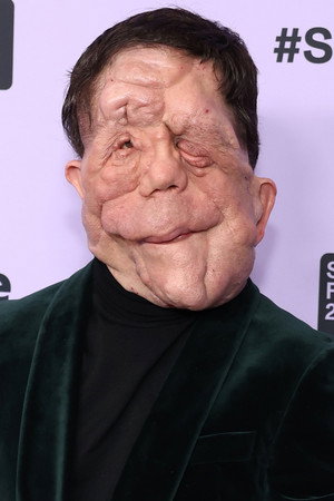 Adam Pearson portrait