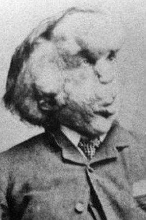 Joseph Merrick portrait