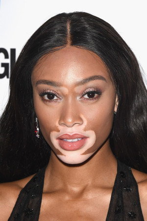 Winnie Harlow portrait