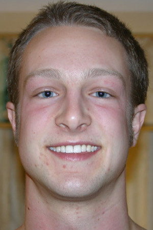 Brock portrait