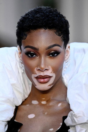 Winnie Harlow portrait