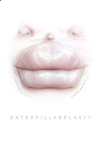 Poster for Caterpillarplasty